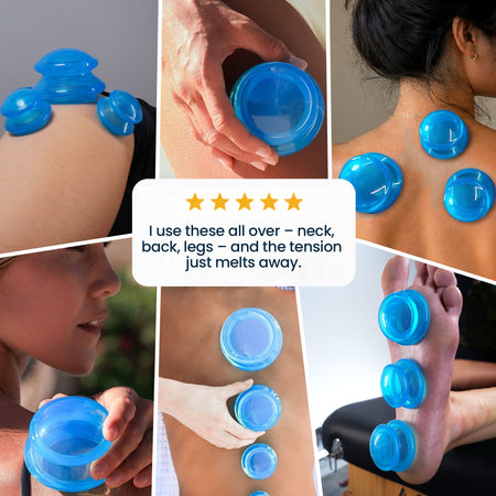 EDGE Silicone Cupping Set